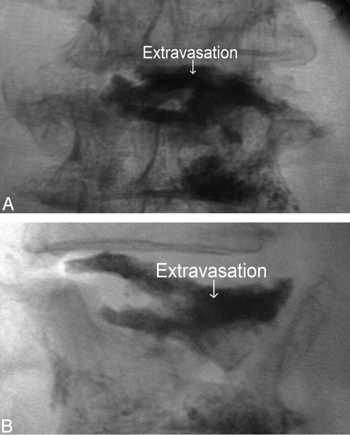 Fig 4.