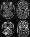 Fig. 3