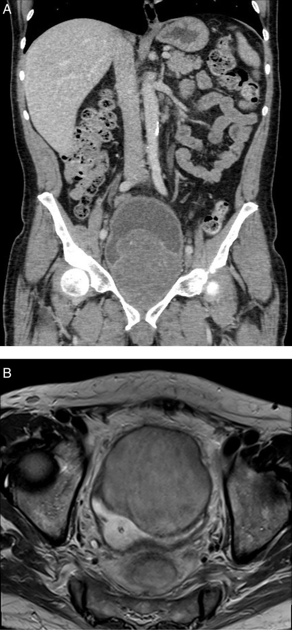 Figure 1