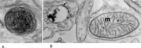 Fig. (1)