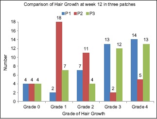 Graph 3