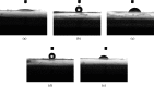 Fig 5