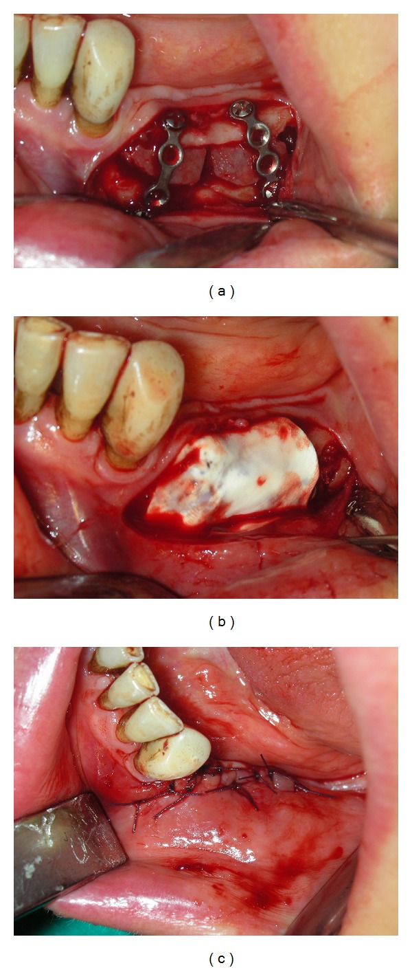 Figure 2