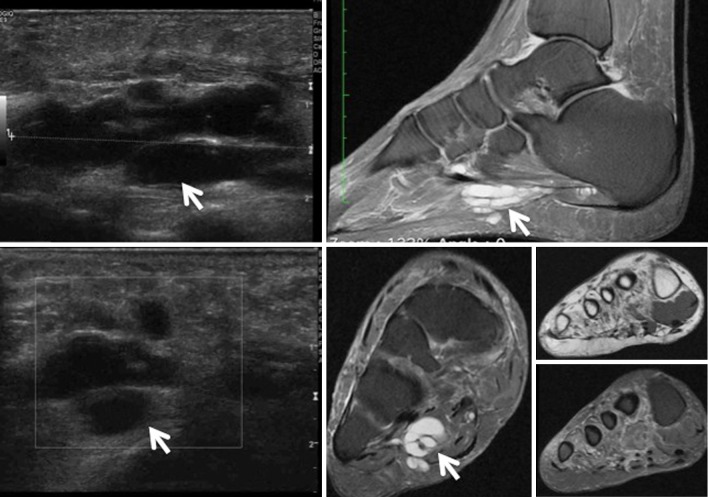 Fig. 12