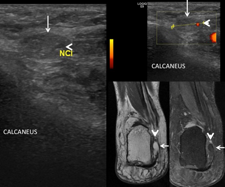 Fig. 14