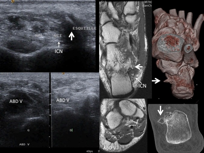 Fig. 16