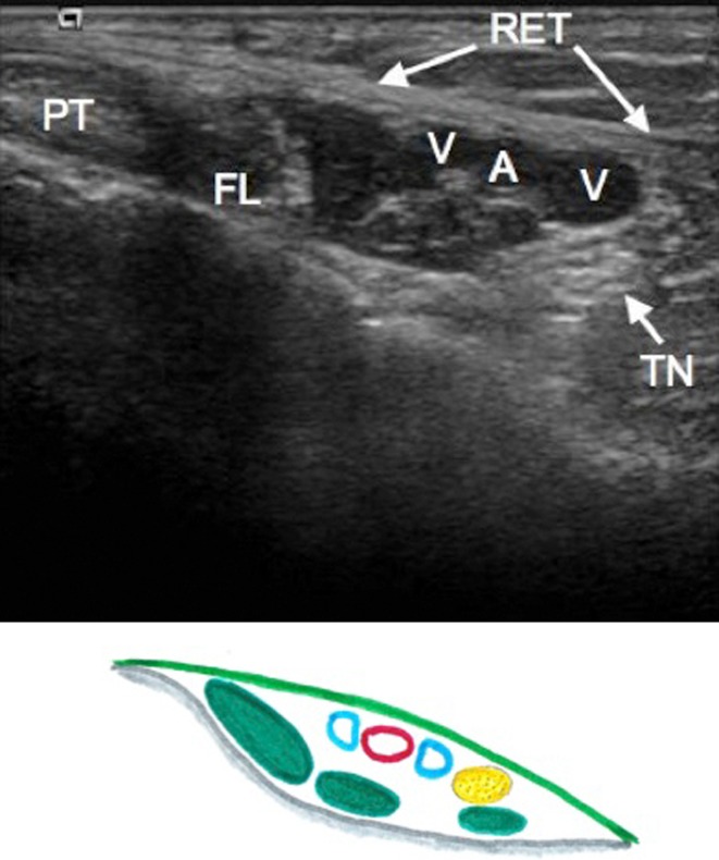 Fig. 3