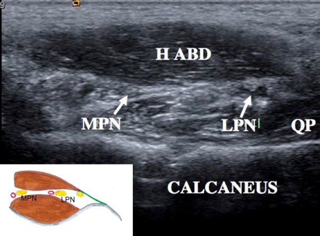 Fig. 4