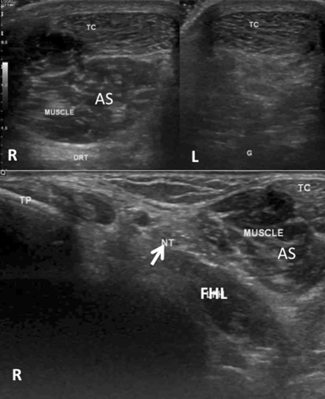 Fig. 10