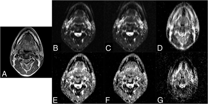 Fig 2.