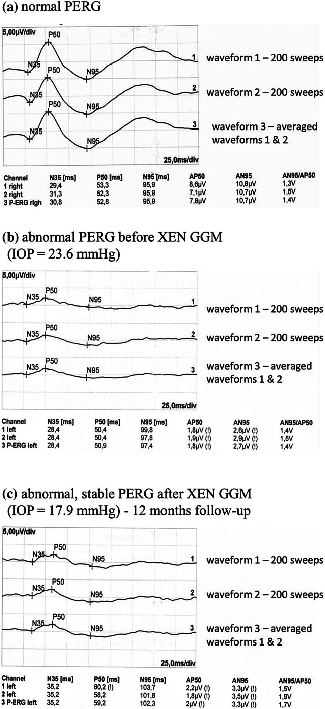 Fig. 1