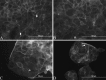 Fig. 14