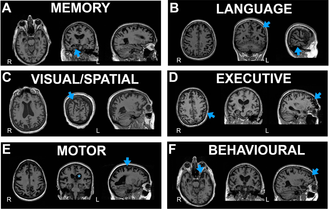 Figure 1: