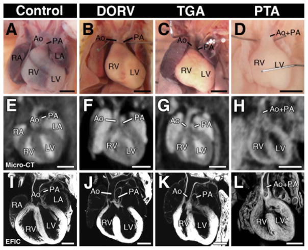 Imaging Techniques For Visualizing And Phenotyping Congenital Heart 