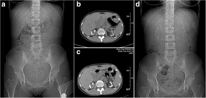 Fig. 2