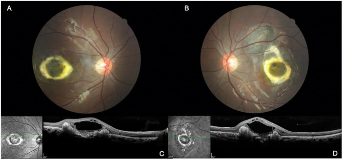 Figure 4.