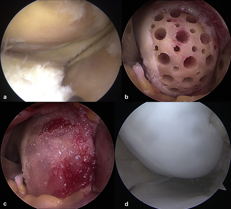 Fig. 1