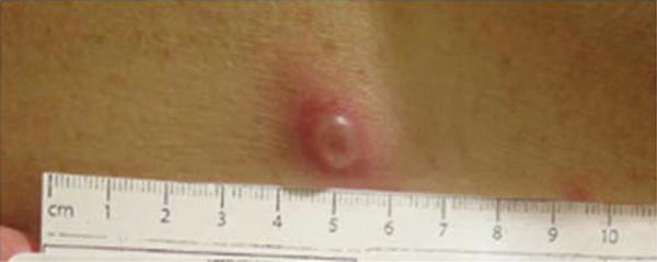 Fig. 10