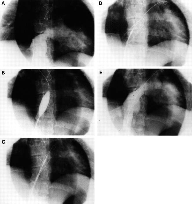 Figure 1  