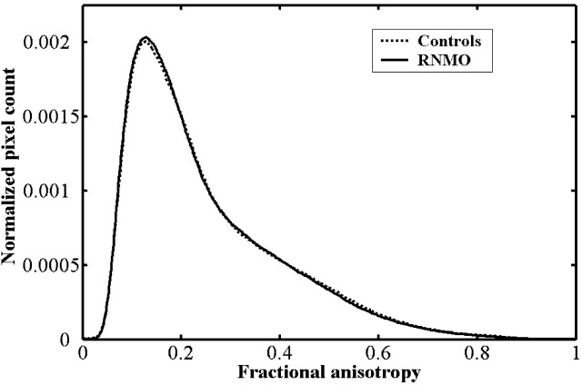 Fig 3.