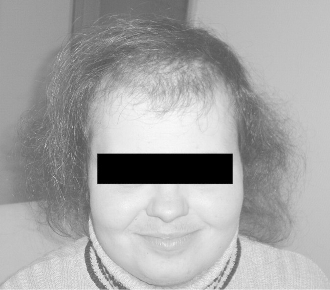 Fig. 1