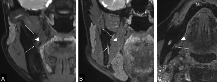 Fig 2.