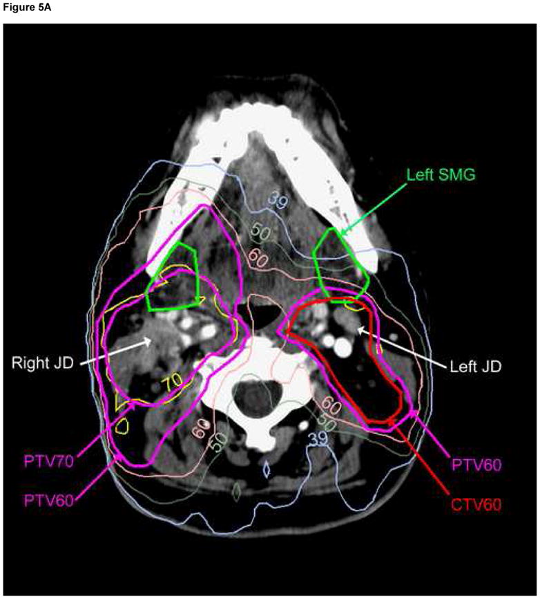 Fig. 5