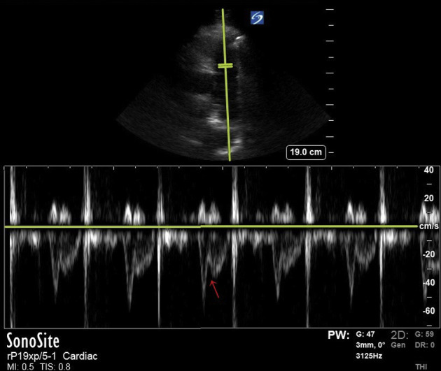 Figure 2