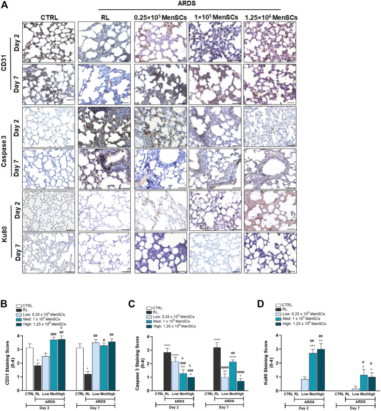 Safety and efficacy of clinical-grade, cryopreserved menstrual blood ...