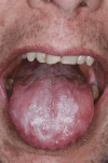 Fig. 4