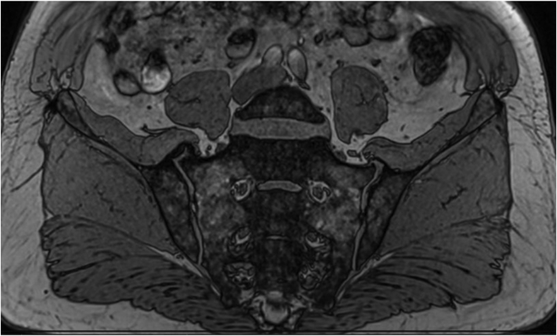 Fig. 12