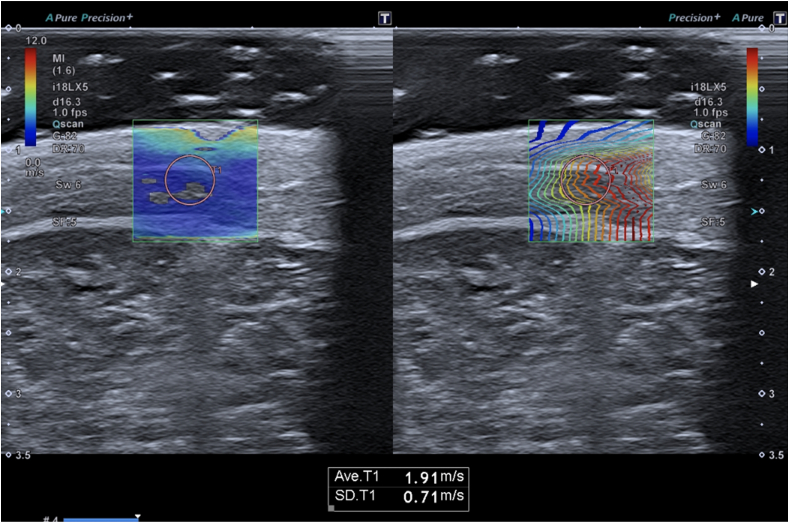 Fig. 3