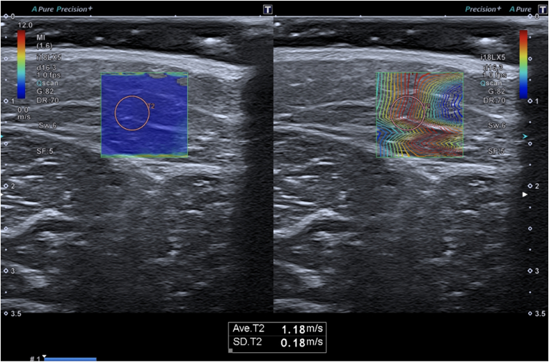 Fig. 3