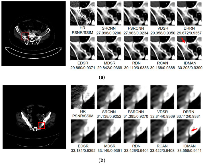 Figure 10