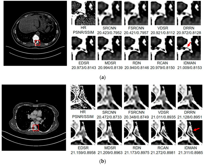 Figure 9