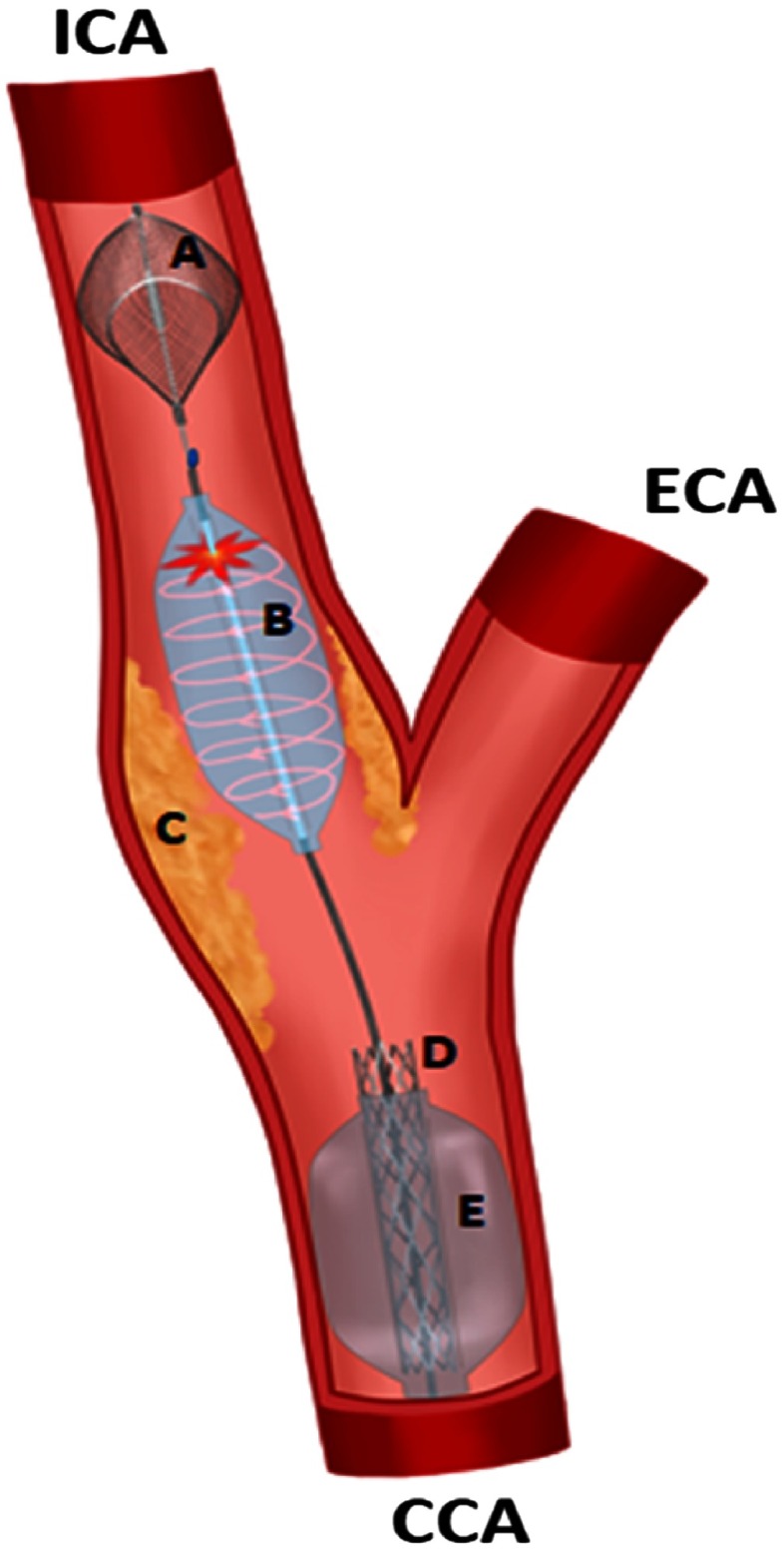 Fig. 2