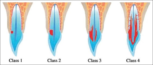 Figure 16