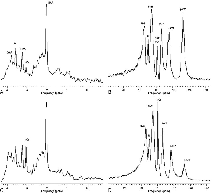 Fig 2.