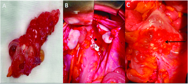 Figure 2: