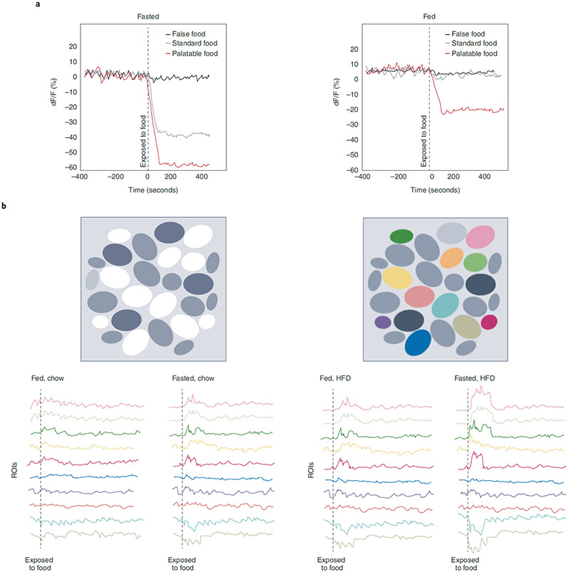 Acts of appetite: neural circuits governing the appetitive ...