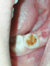 Figura 3