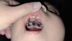 Figura 12