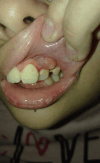 Figura 14