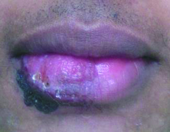 Fig. 4