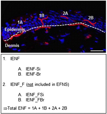 Fig. 1