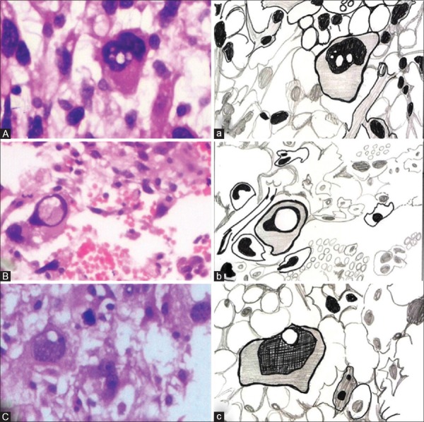 Nuclear vacuolization: Giant Lochkern-like cells - PMC