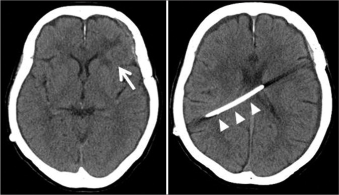 Figure 1: