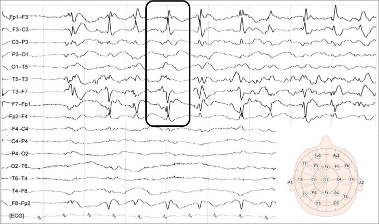 Figure 2: