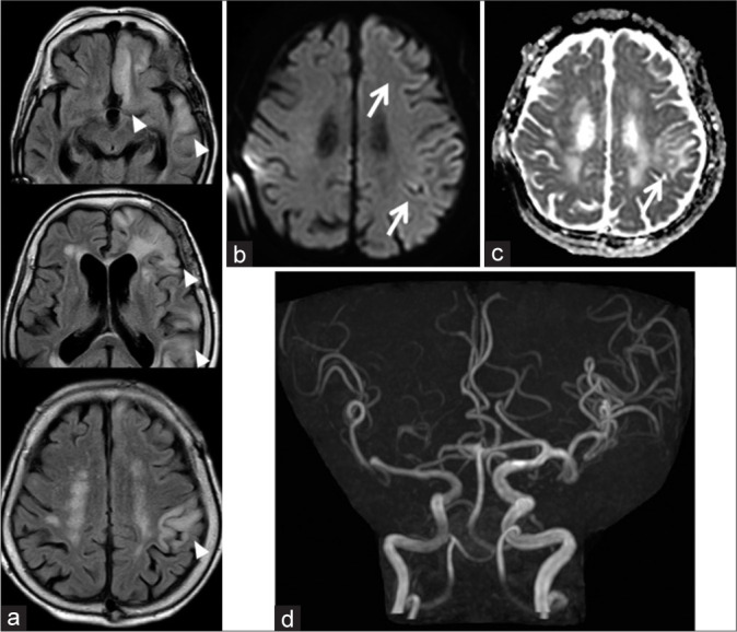 Figure 3: