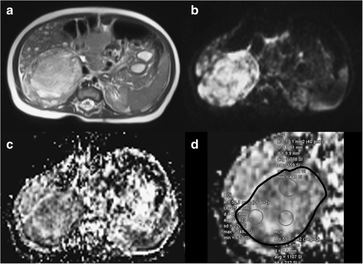 Fig. 2